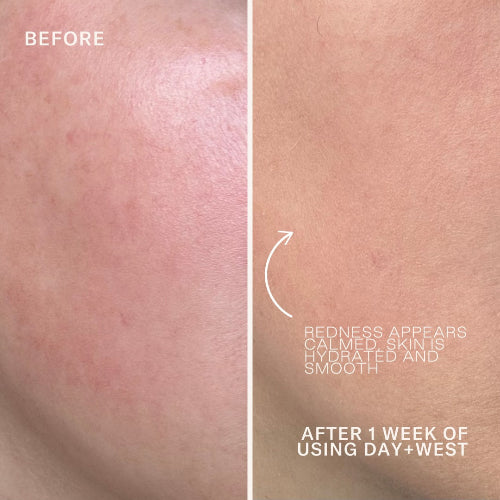 Quiet force face oil before and after