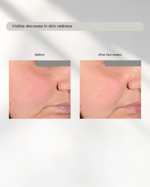 The Innovator Modern Age Skin before and after