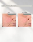 The Innovator Modern Age Skin before and after