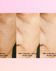 Before and after comparison of skin texture using B.Skin Tight product on a pink background.