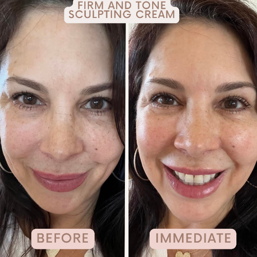 Auve Beauty firm and tone sculpting cream before and after