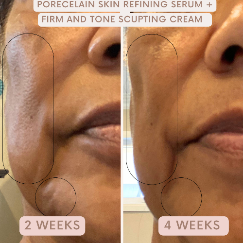 Auve Beauty Firm and Tone Sculpting Cream results