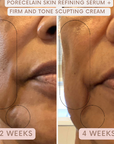 Auve Beauty Firm and Tone Sculpting Cream results