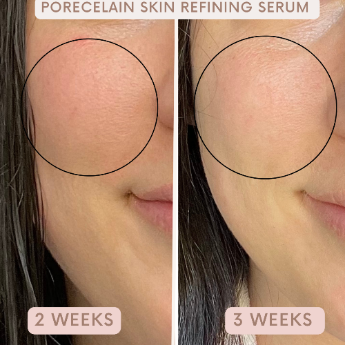 Auve Beauty skin refining serum results
