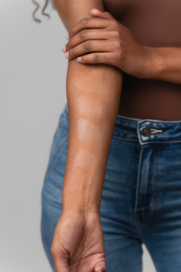 Corsica Pixie on arm