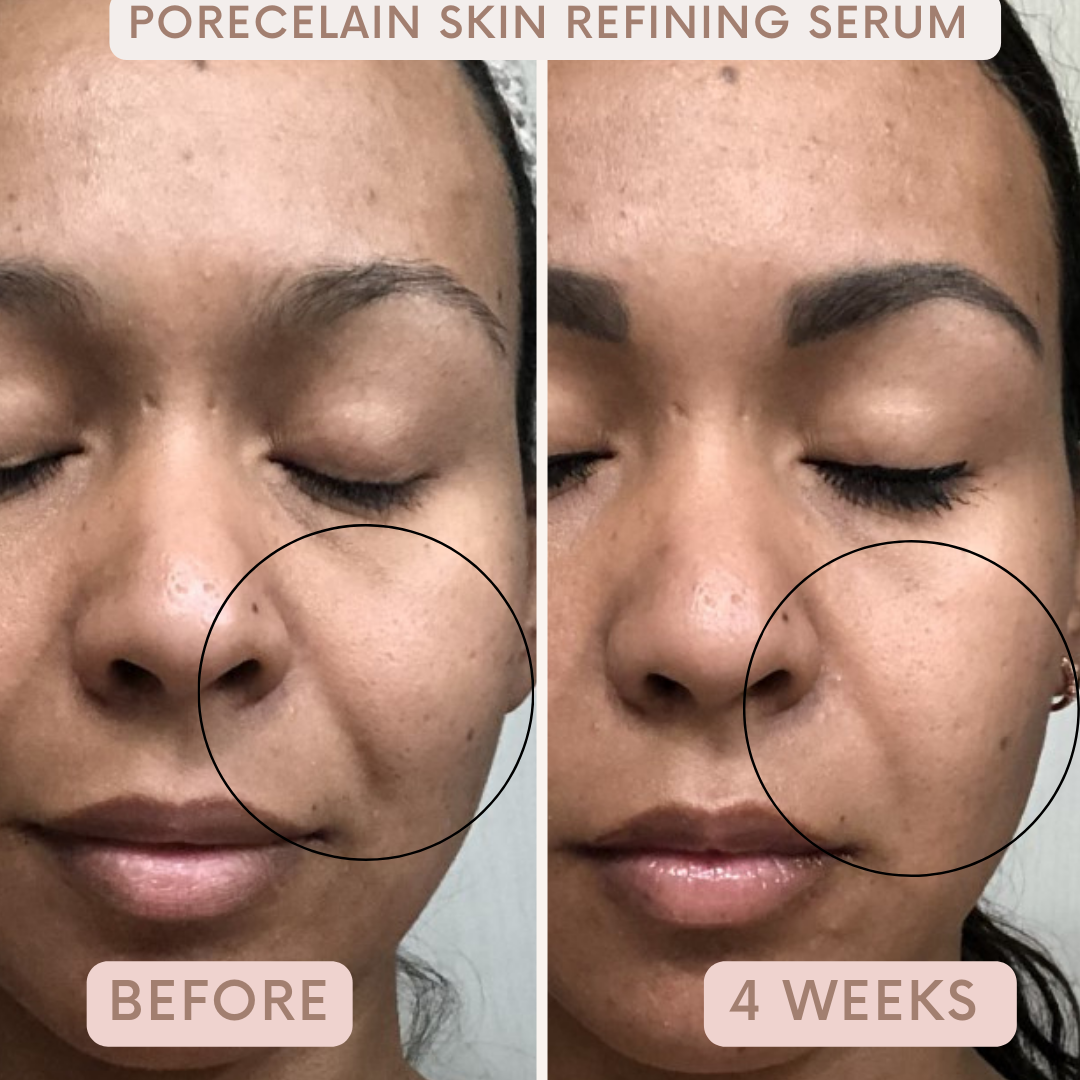 Porecelain™ Skin Refining Serum by Auvê® Beauty