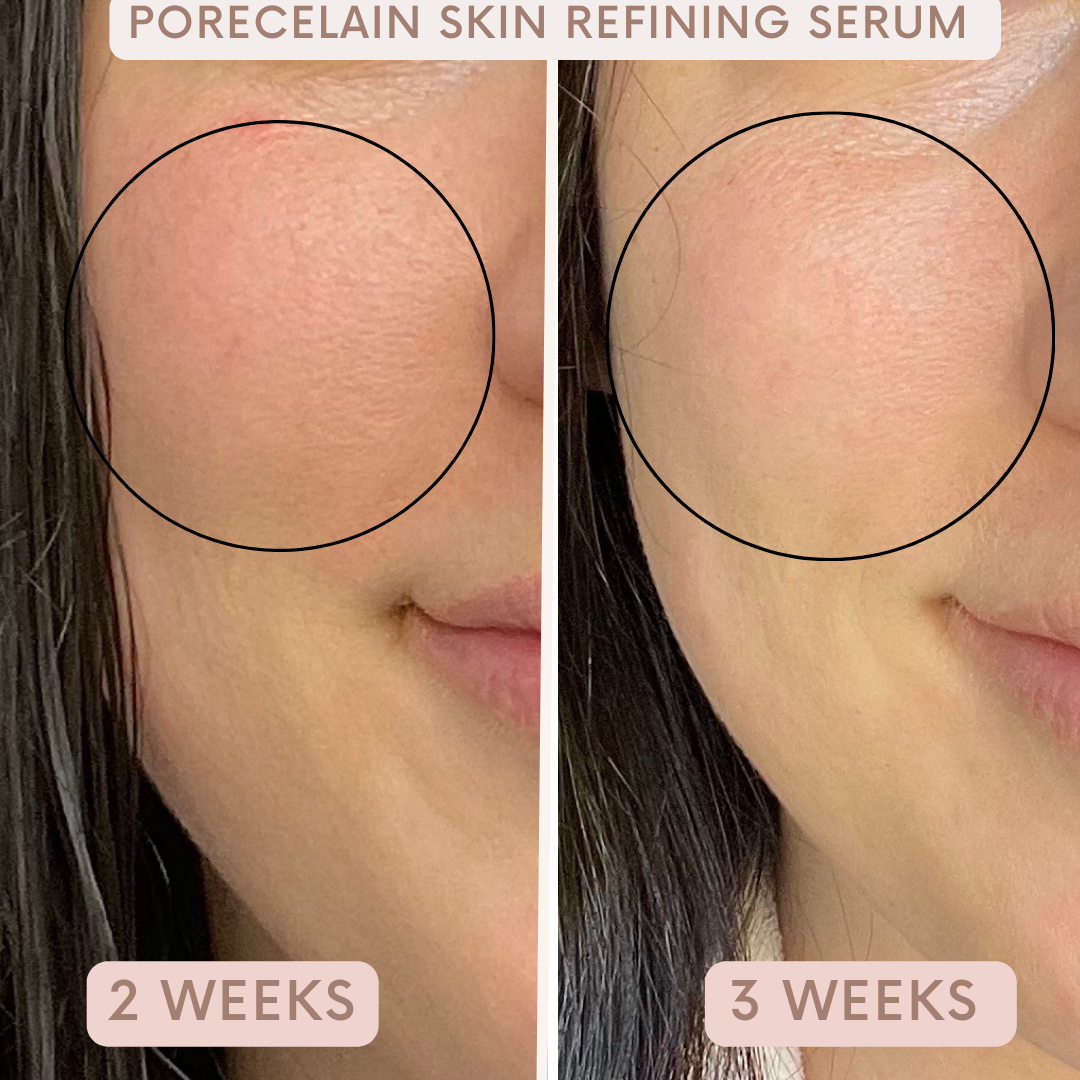 Porecelain™ Skin Refining Serum by Auvê® Beauty