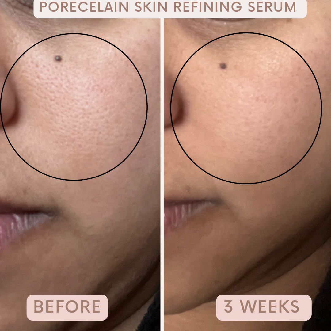 Porecelain™ Skin Refining Serum by Auvê® Beauty