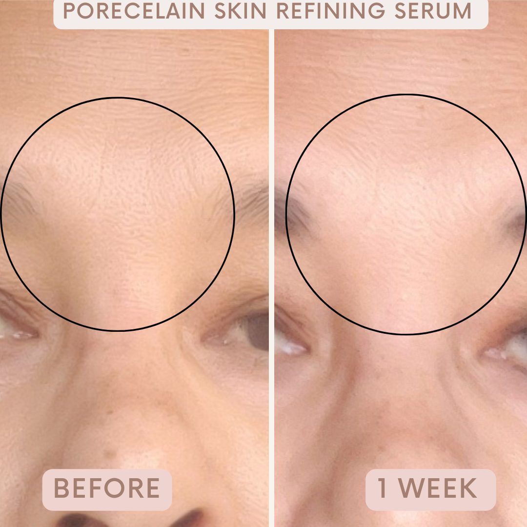 Porecelain™ Skin Refining Serum by Auvê® Beauty