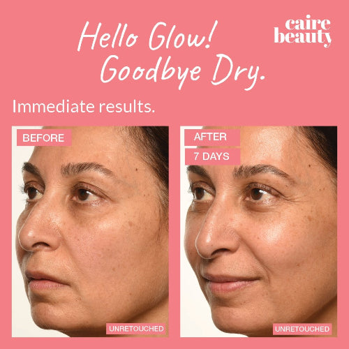 Caire Beauty before and after